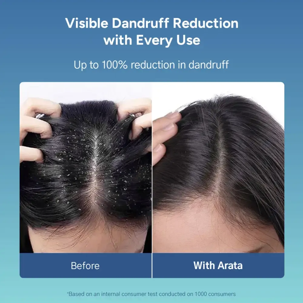 Dandruff Detox Duo - Normal to Oily Hair - Shampoo 200ml + Conditioner 200ml - Image 3