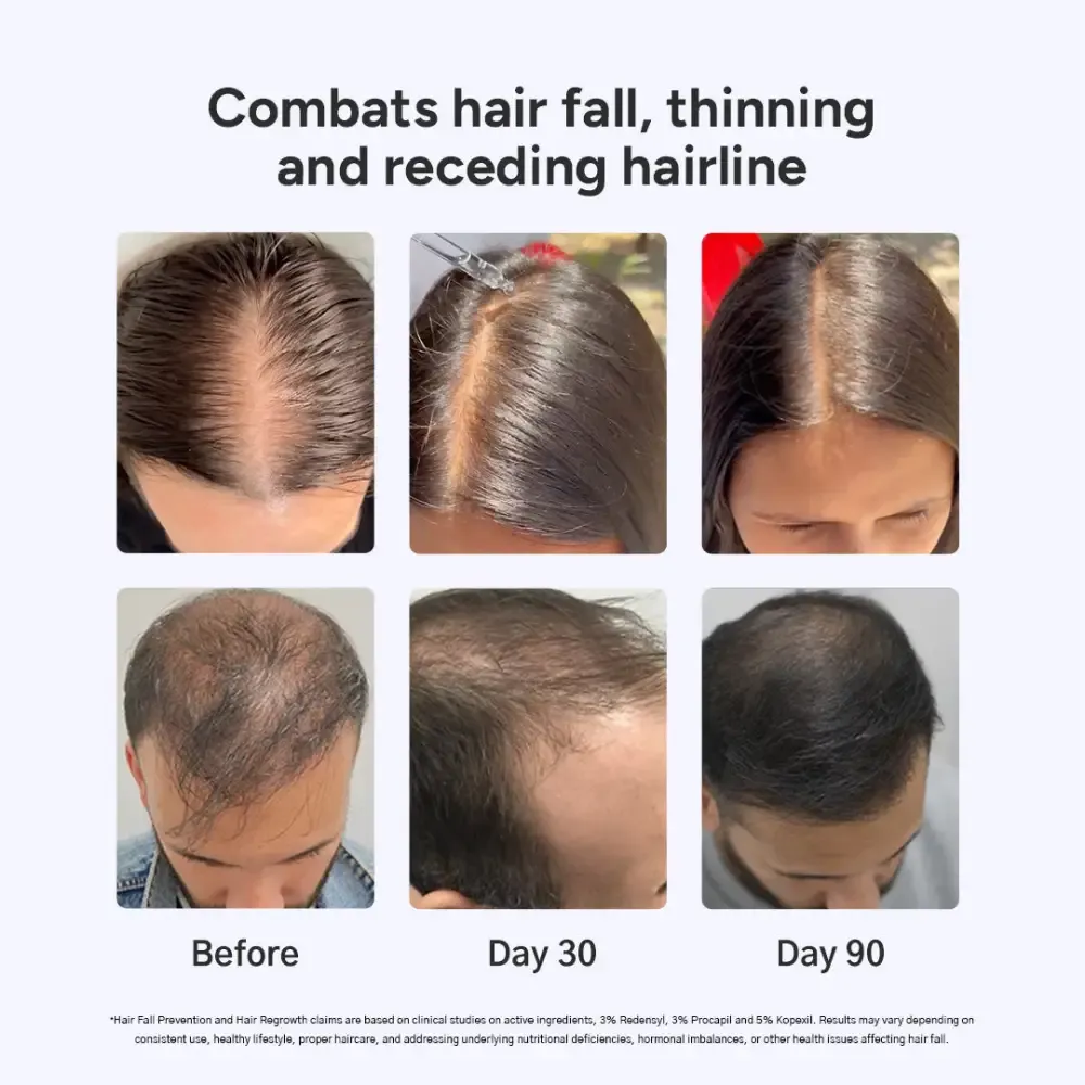 Arata 60-Day Value Pack for Fuller, Denser, Thicker Hair Regrowth | Intensive Hair Growth Serum (Pack of 2) | Free Derma Roller - Image 4